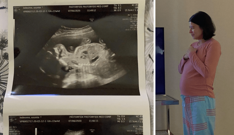 LOOK: Assunta de Rossi shares ultrasound photos of her miracle baby
