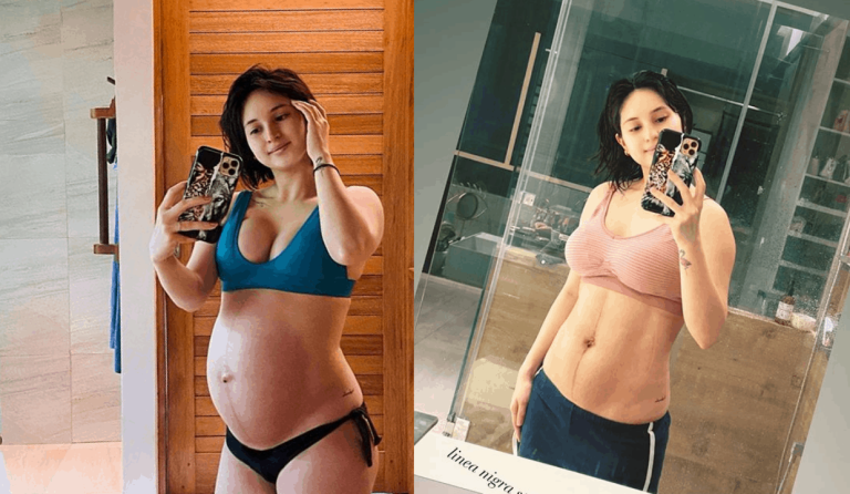 Coleen Garcia shares photo of postpartum body