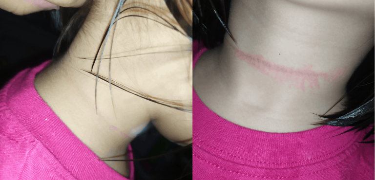 Mom issues warning after kid’s life put in danger over TikTok video