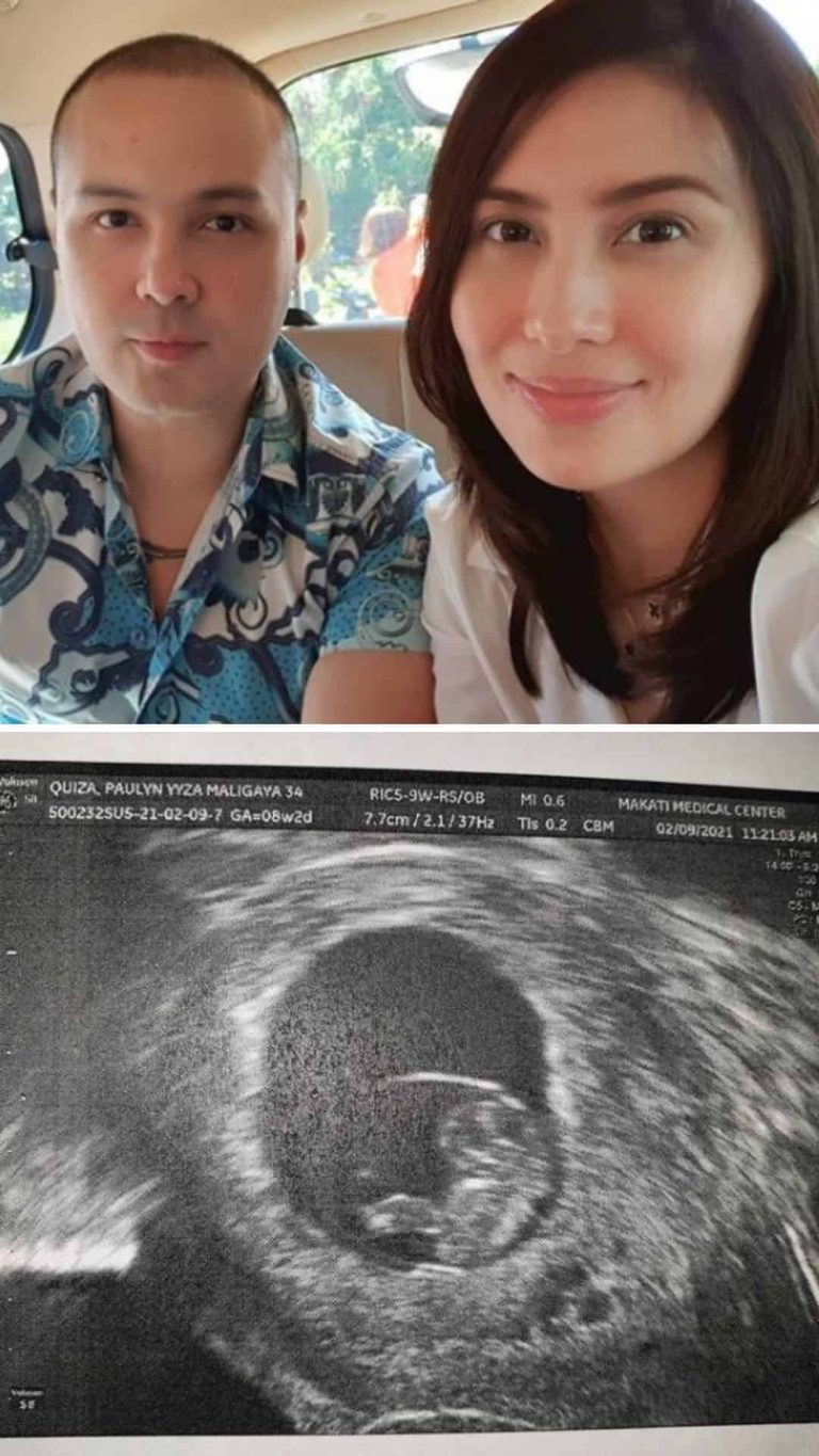 Polo Ravales and fiancée expecting first child