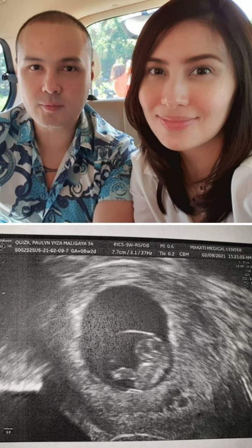Polo Ravales and fiancée expecting first child