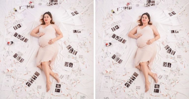 Nadine Samonte tells her PCOS and APAS story in maternity shoot