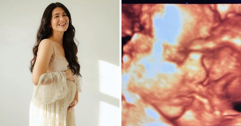 ‘Can’t wait to hold you in our arms’: Dimples Romana shares sonogram of baby boy
