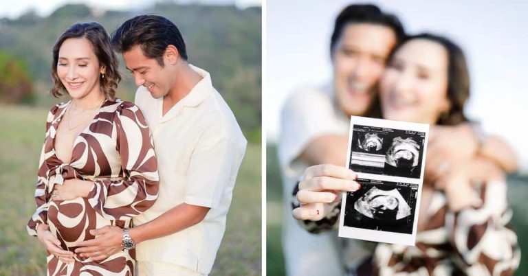 Rocco Nacino and Melissa Gohing expecting first baby