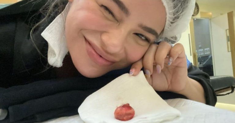 Denise Laurel goes through surgery to remove cyst