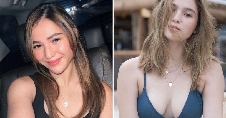 Barbie Imperial denies getting a boob and nose job