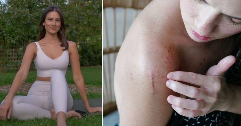 Bianca King recalls struggles after misdiagnosed injury