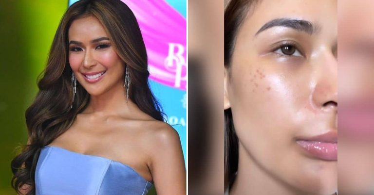 ‘This is me’: Samantha Bernardo flexes unfiltered look