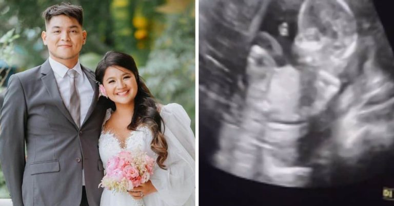 ‘Blessings after blessings’: Ynna Asistio gets married, expecting first child