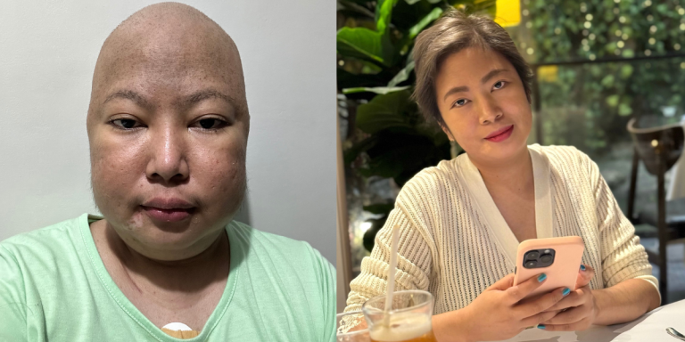 Cancer patient wows netizens with confidence in her before and after photos