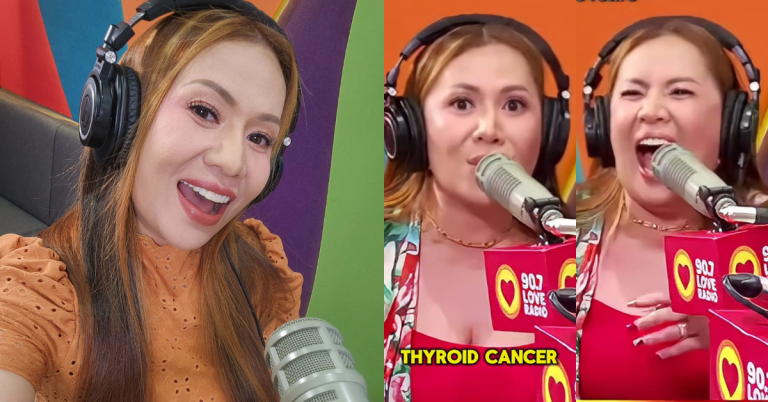 ‘Pagtatagumpayan ko ito’: Nicole Hyala faces thyroid cancer with optimism and faith