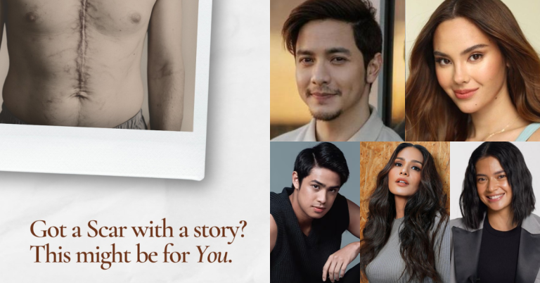 Celebrities show support for project that turns scars into stories of hope