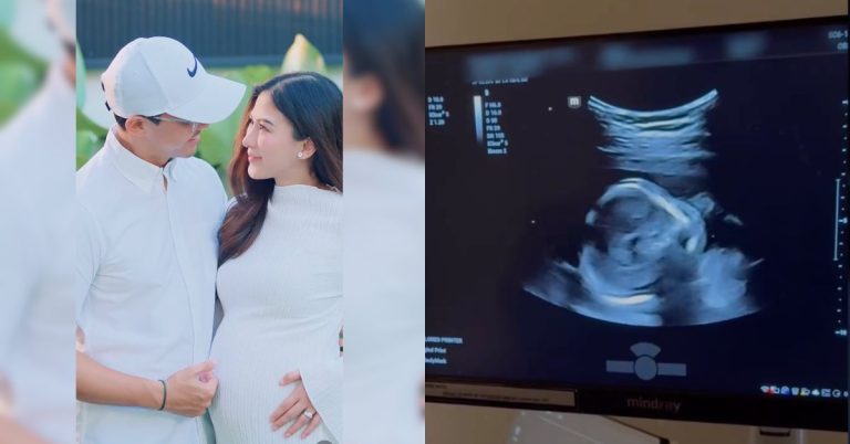‘Our prayers have been answered’: Alex Gonzaga is expecting baby with Mikee Morada